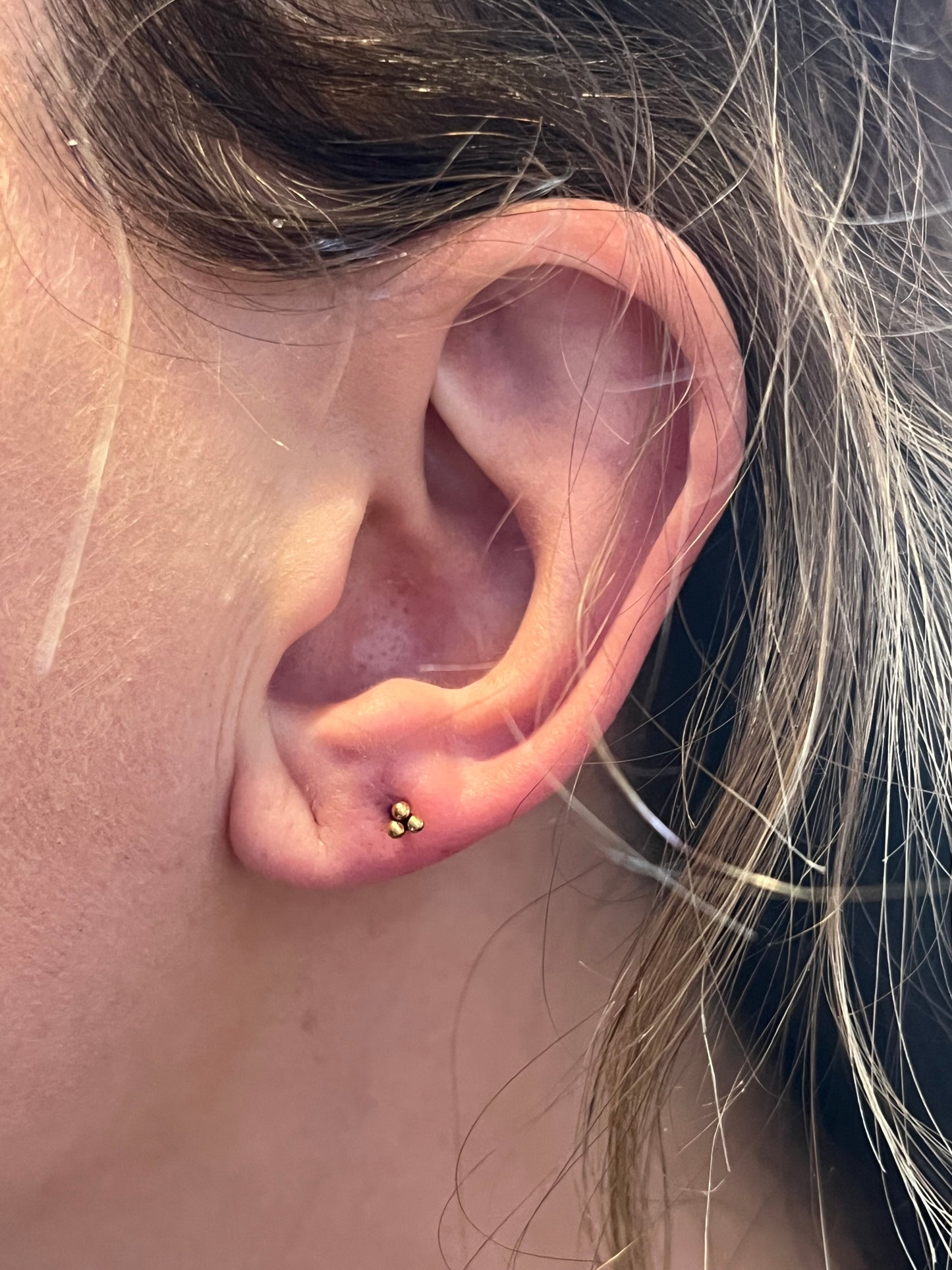 Needle Piercing-Earlobe